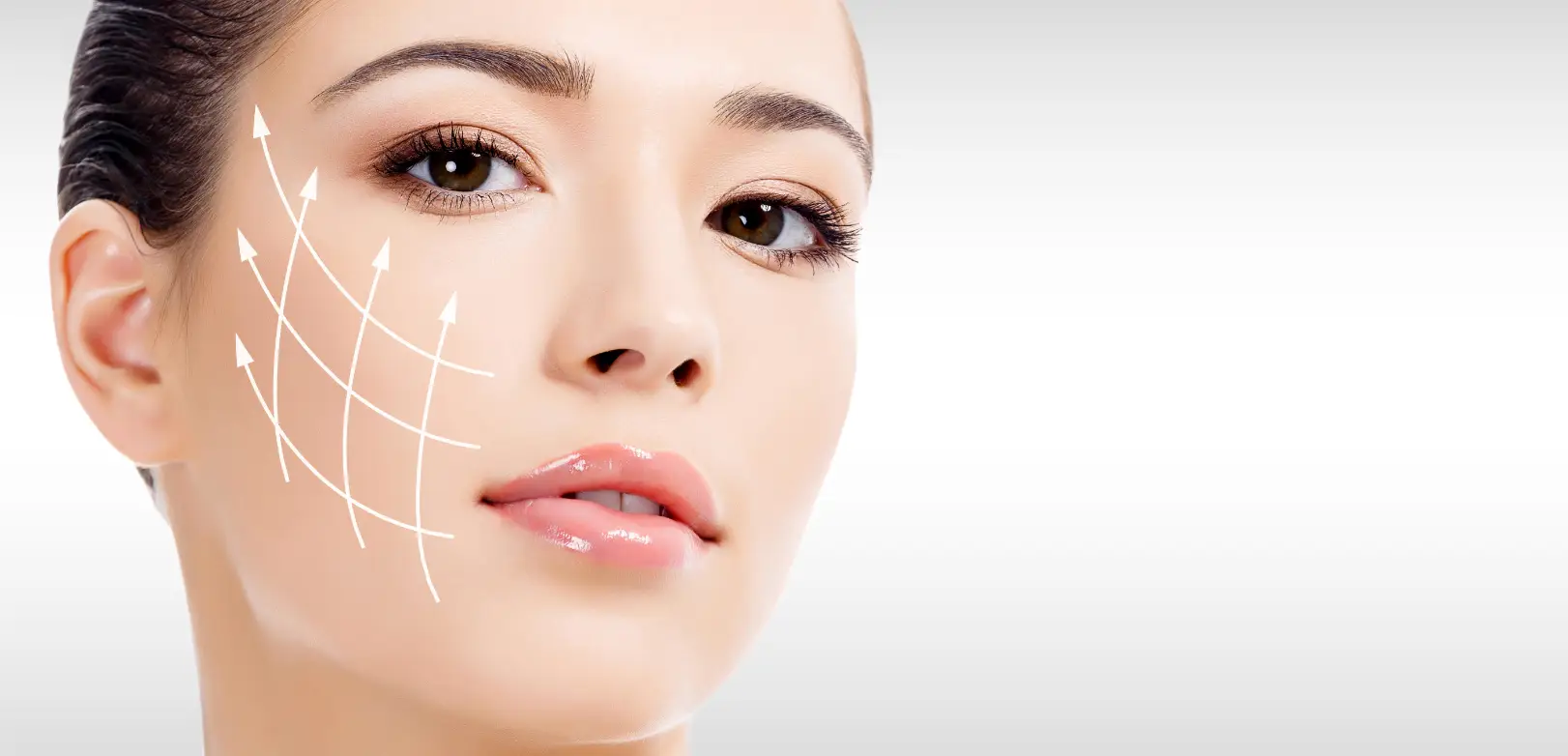 Close-up of a face with white curved arrows over the cheek indicating upward lifting directions.